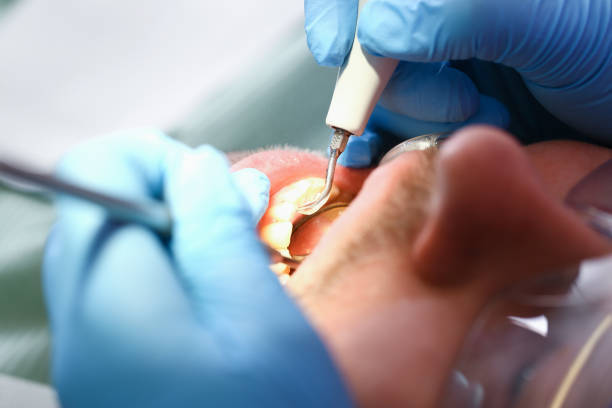 Best Broken or Cracked Tooth Emergency Dentist in Langston, OK
