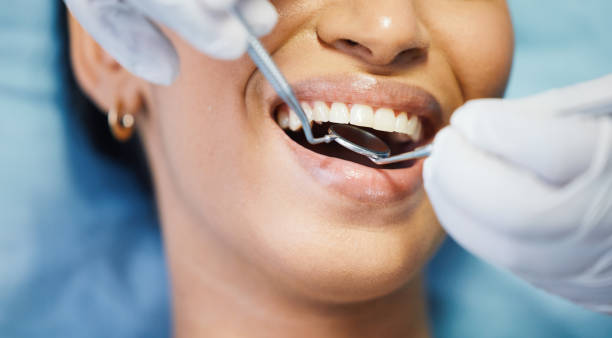 Best Urgent Dental Care for Toothache in Langston, OK