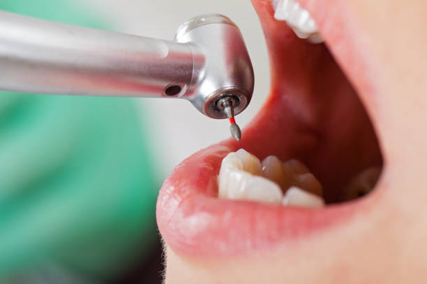 Best Emergency Dental Services for Seniors in Langston, OK